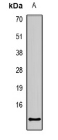 CCL27 Rabbit Polyclonal Antibody