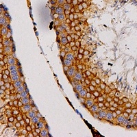 CCL27 Rabbit Polyclonal Antibody