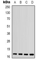 IL-1F10 Rabbit Polyclonal Antibody