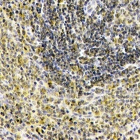 IL-1F10 Rabbit Polyclonal Antibody