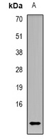 CCL4L1 Rabbit Polyclonal Antibody