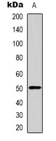 GDF6 Rabbit Polyclonal Antibody