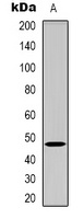 GDF7 Rabbit Polyclonal Antibody