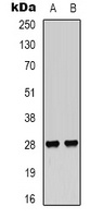 VEGI Rabbit Polyclonal Antibody