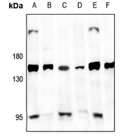GPR126 Rabbit Polyclonal Antibody