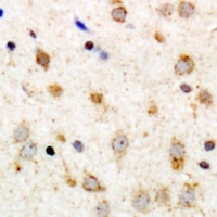 GPR126 Rabbit Polyclonal Antibody