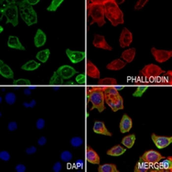 GPR126 Rabbit Polyclonal Antibody