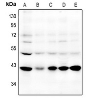 GPR87 Rabbit Polyclonal Antibody