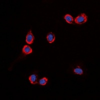 GPR87 Rabbit Polyclonal Antibody