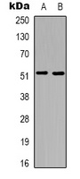Tachykinin Receptor 3 Rabbit Polyclonal Antibody