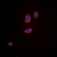 Tachykinin Receptor 3 Rabbit Polyclonal Antibody