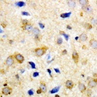 NPY5R Rabbit Polyclonal Antibody
