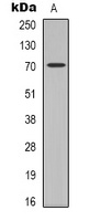 ZAP70 Rabbit Polyclonal Antibody