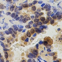ZAP70 Rabbit Polyclonal Antibody