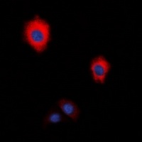ZAP70 Rabbit Polyclonal Antibody