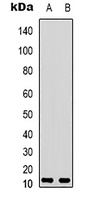 VIP Rabbit Polyclonal Antibody