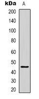ACADM Rabbit Polyclonal Antibody