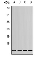 MIF Rabbit Polyclonal Antibody