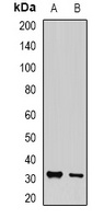 PA28 gamma Rabbit Polyclonal Antibody