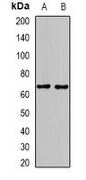 GAD2 Rabbit Polyclonal Antibody