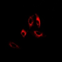 GAD2 Rabbit Polyclonal Antibody