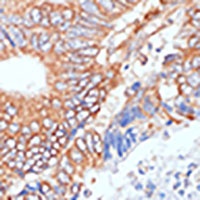 Alpha-enolase Rabbit Polyclonal Antibody