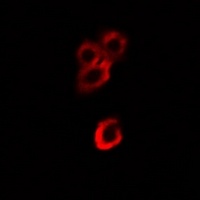 Alpha-enolase Rabbit Polyclonal Antibody