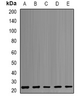 PSMB1 Rabbit Polyclonal Antibody