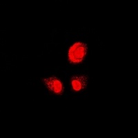 PSMB1 Rabbit Polyclonal Antibody