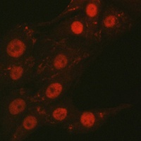 CTCF Rabbit Polyclonal Antibody