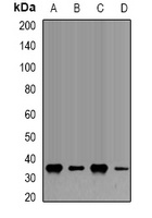 Fibrillarin Rabbit Polyclonal Antibody