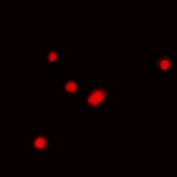 Fibrillarin Rabbit Polyclonal Antibody