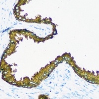 RRM1 Rabbit Polyclonal Antibody