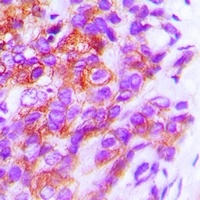 HLA-DPB1 Rabbit Polyclonal Antibody