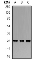 PRDX4 Rabbit Polyclonal Antibody