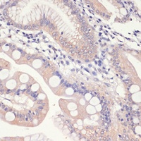HMGCR Rabbit Polyclonal Antibody