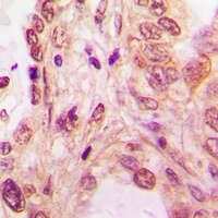 SF2 Rabbit Polyclonal Antibody
