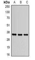 ANT1 Rabbit Polyclonal Antibody