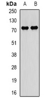 PADI4 Rabbit Polyclonal Antibody