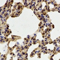 PADI4 Rabbit Polyclonal Antibody