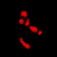 PADI4 Rabbit Polyclonal Antibody