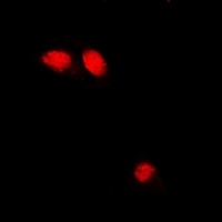 Troponin C Rabbit Polyclonal Antibody