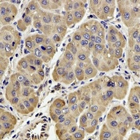 GPx-4 Rabbit Polyclonal Antibody