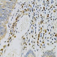 CDA Rabbit Polyclonal Antibody