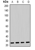 AK4 Rabbit Polyclonal Antibody