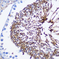SPAM1 Rabbit Polyclonal Antibody