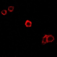 SPAM1 Rabbit Polyclonal Antibody