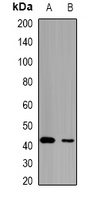 HCCR-1 Rabbit Polyclonal Antibody