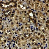 HCCR-1 Rabbit Polyclonal Antibody