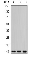 EDF1 Rabbit Polyclonal Antibody